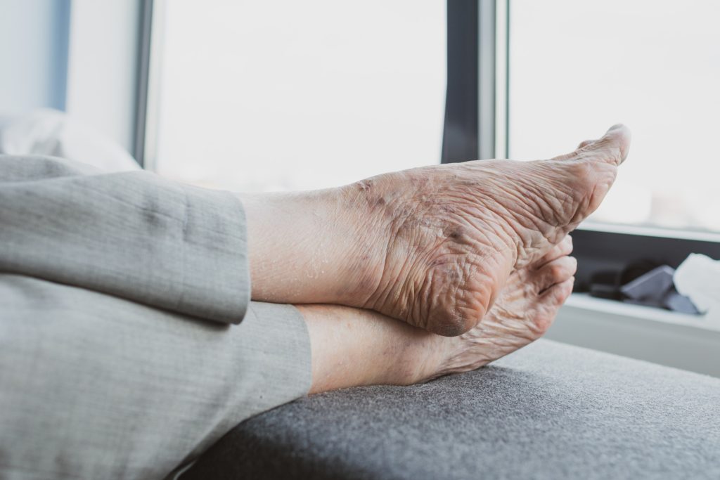 Imagen de unos pies en reposo de una persona mayor.