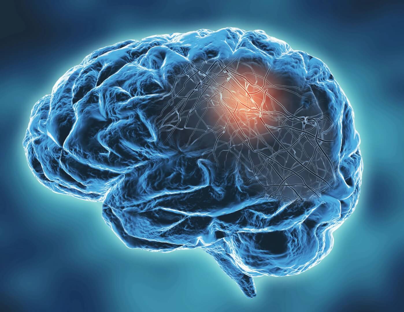 Una imagen en 3D de un cerebro humano. 