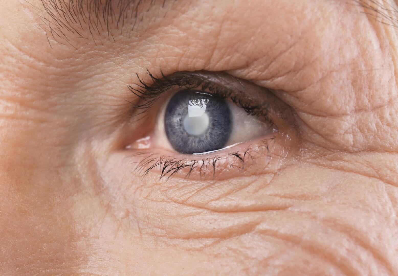 Un plano detalle de un ojo azul de una mujer mayor. 